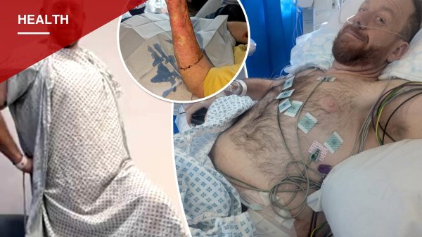 Dudley man rebuilds his life after penile cancer forced full reconstruction