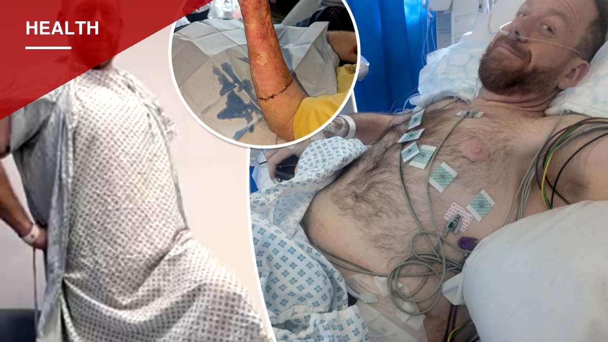 Dudley man rebuilds his life after penile cancer forced full reconstruction